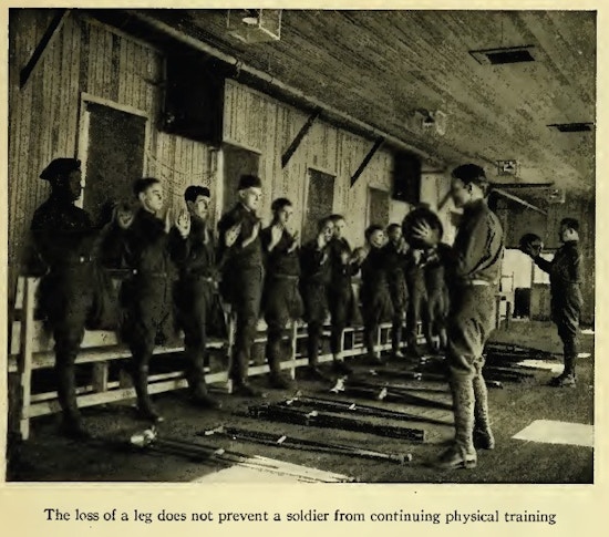 About a dozen one-legged men stand in a row, facing men holding exercise balls.  crutches lie on the floor.