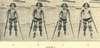 Four photographs of a child walking with crutches and braces.