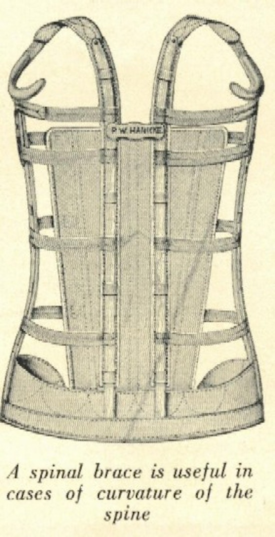 A drawing of a back brace.