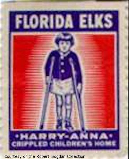 Stamp showing a young girl using crutches.