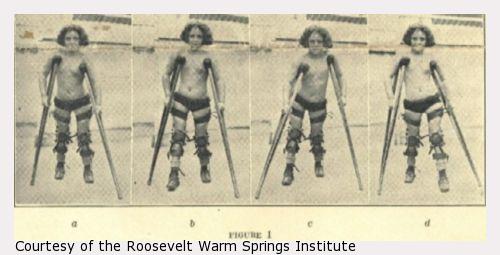 Four photographs of a child walking with crutches and braces.